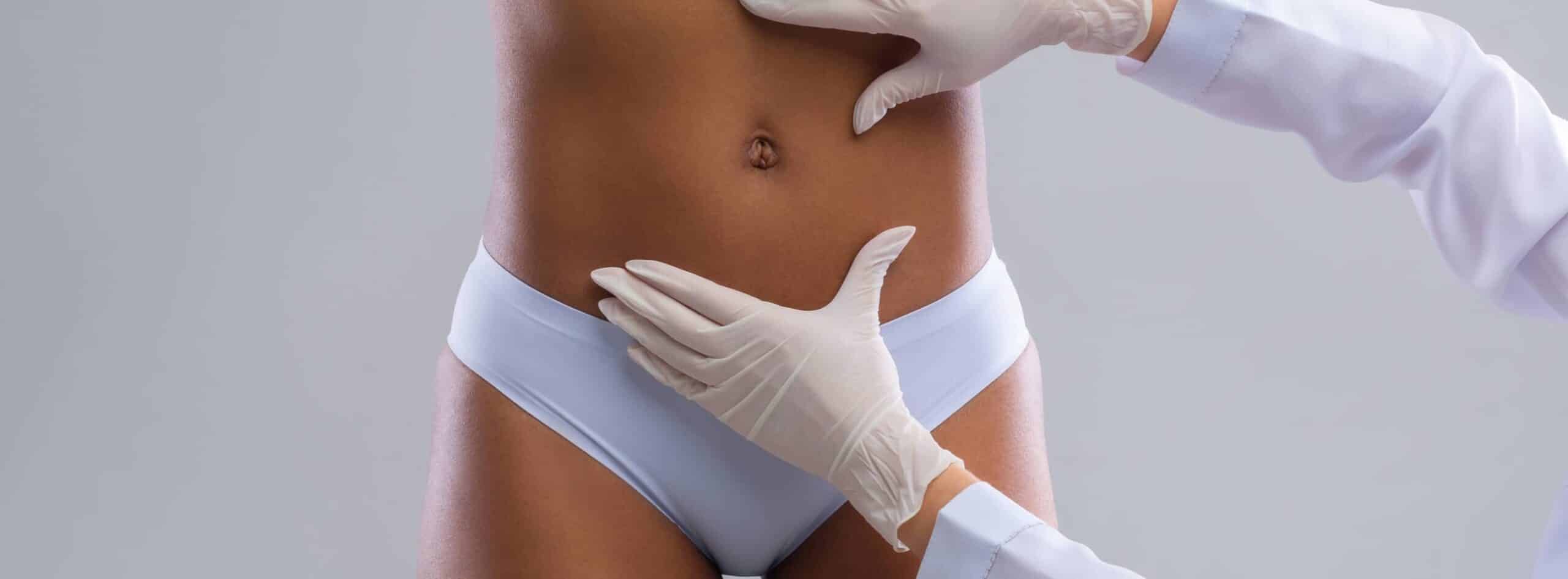 Les questions à poser avant une liposuccion | Drs Kerfant et Trimaille | Brest