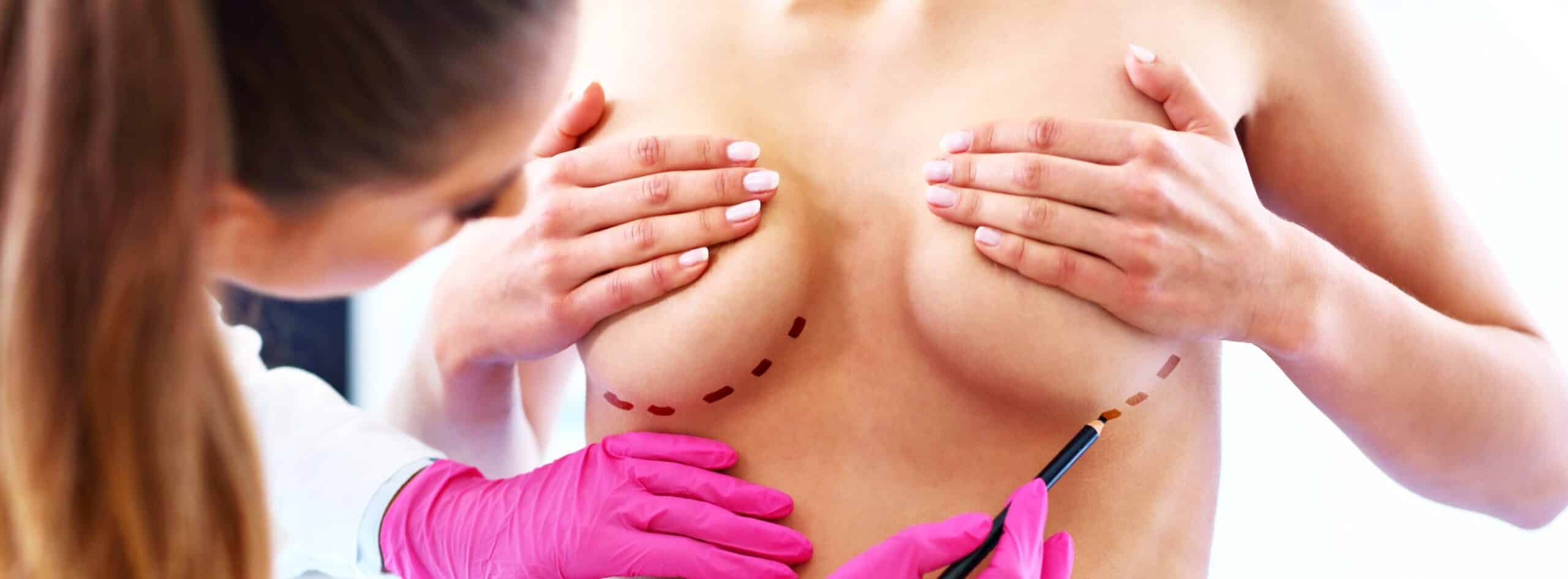 Comment se faire rembourser sa chirurgie mammaire ? | Drs Kerfant et Trimaille | Brest